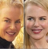 nicole kidman mı daha güzel ben mi aşkım / #106186